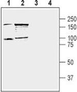 DPP10 (extracellular) Antibody in Western Blot (WB)