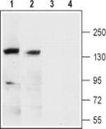 KCNMA1 (extracellular) Antibody in Western Blot (WB)
