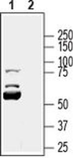 KCNK16 (extracellular) Antibody in Western Blot (WB)