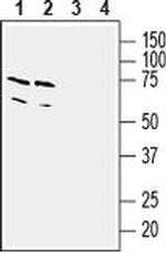 TBXA2R Antibody in Western Blot (WB)