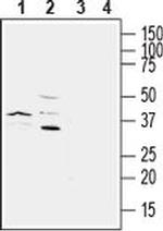 P2Y6 (extracellular) Antibody in Western Blot (WB)