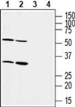 P2Y6 (extracellular) Antibody in Western Blot (WB)