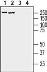 AKAP12 Antibody in Western Blot (WB)