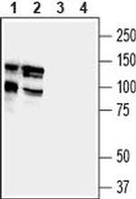 SAPAP1 Antibody in Western Blot (WB)