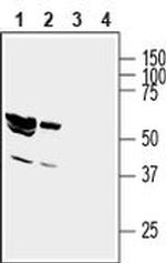 GIPC1 Antibody in Western Blot (WB)