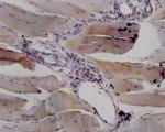 RyR1 Antibody in Immunohistochemistry (Paraffin) (IHC (P))