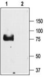SCNN1G (extracellular) Antibody in Western Blot (WB)