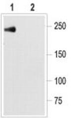 SCN5A Antibody in Western Blot (WB)