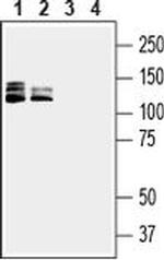 CD100 (extracellular) Antibody in Western Blot (WB)