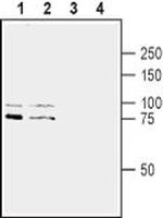 SLITRK1 (extracellular) Antibody in Western Blot (WB)