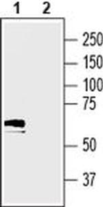 SLC17A5 Antibody in Western Blot (WB)