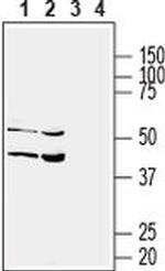 SLC17A5 Antibody in Western Blot (WB)