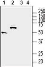 SLC17A5 Antibody in Western Blot (WB)