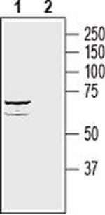 SLC39A8 (extracellular) Antibody in Western Blot (WB)