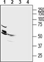 SLC30A2 Antibody in Western Blot (WB)
