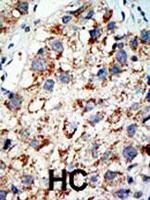 UBA2 Polyclonal Antibody