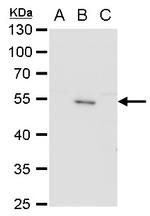 Japanese Encephalitis Envelope Protein Antibody in Western Blot (WB)