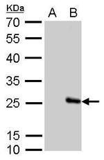 Influenza B M Polyclonal Antibody