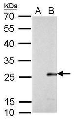 Influenza B M Antibody in Western Blot (WB)