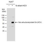 Hepatitis C Virus NS5A Polyclonal Antibody