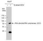 Hepatitis C Virus NS5b Polyclonal Antibody
