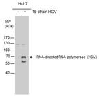 Hepatitis C Virus NS5b Polyclonal Antibody