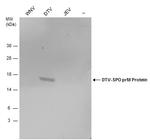 Powassan Virus prM Protein Antibody in Western Blot (WB)