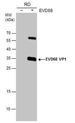 Enterovirus D68 VP1 Polyclonal Antibody