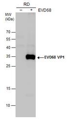 Enterovirus D68 VP1 Polyclonal Antibody