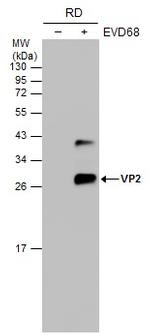 Enterovirus D68 VP2 Polyclonal Antibody