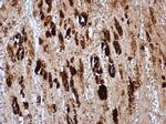 Enterovirus 71 VP1 Antibody in Immunohistochemistry (Paraffin) (IHC (P))