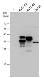 Enterovirus 71 VP1 Antibody in Western Blot (WB)