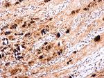Enterovirus 71 VP1 Antibody in Immunohistochemistry (Paraffin) (IHC (P))