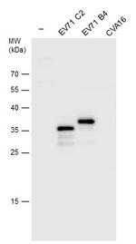 Enterovirus 71 VP1 Antibody in Western Blot (WB)