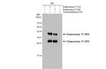 Enterovirus 71 VP2 Antibody in Western Blot (WB)