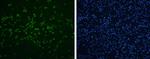 Enterovirus 71 VP2 Polyclonal Antibody