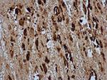 Enterovirus 71 VP2 Antibody in Immunohistochemistry (Paraffin) (IHC (P))