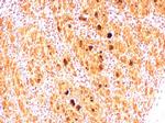 Enterovirus 71 2B Polyclonal Antibody