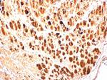 Enterovirus 71 3AB Polyclonal Antibody