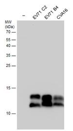 Enterovirus 71 3AB Antibody in Western Blot (WB)