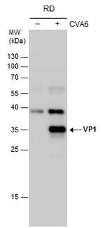 Coxsackievirus A6 VP1 Antibody in Western Blot (WB)