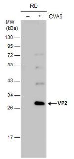 Coxsackievirus A6 VP2 Antibody in Western Blot (WB)