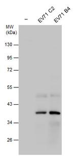 Enterovirus 71 2C Polyclonal Antibody