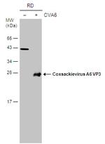 Coxsackievirus A6 VP3 Antibody in Western Blot (WB)