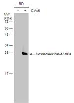 Coxsackievirus A6 VP3 Polyclonal Antibody