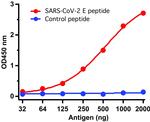 SARS-CoV-2 Envelope Antibody in ELISA (ELISA)