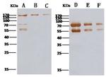MERS Coronavirus Spike Protein S2 Antibody in Western Blot (WB)