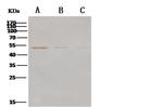 MERS Coronavirus NP Polyclonal Antibody