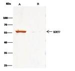 Cytokeratin 7 Antibody in Immunoprecipitation (IP)