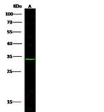 Noggin Polyclonal Antibody
